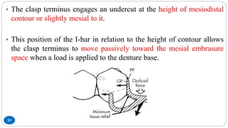 55
• The clasp terminus engages an undercut at the height of mesiodistal
contour or slightly mesial to it.
• This position of the I-bar in relation to the height of contour allows
the clasp terminus to move passively toward the mesial embrasure
space when a load is applied to the denture base.
 