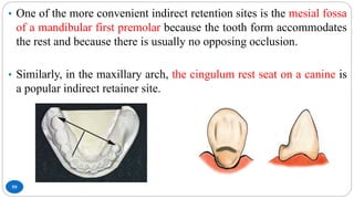 59
• One of the more convenient indirect retention sites is the mesial fossa
of a mandibular first premolar because the tooth form accommodates
the rest and because there is usually no opposing occlusion.
• Similarly, in the maxillary arch, the cingulum rest seat on a canine is
a popular indirect retainer site.
 