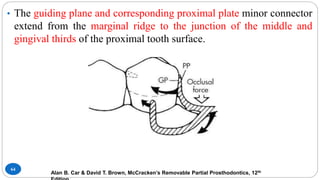 64
• The guiding plane and corresponding proximal plate minor connector
extend from the marginal ridge to the junction of the middle and
gingival thirds of the proximal tooth surface.
Alan B. Car & David T. Brown, McCracken’s Removable Partial Prosthodontics, 12th
 