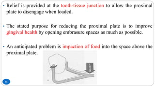 66
• Relief is provided at the tooth-tissue junction to allow the proximal
plate to disengage when loaded.
• The stated purpose for reducing the proximal plate is to improve
gingival health by opening embrasure spaces as much as possible.
• An anticipated problem is impaction of food into the space above the
proximal plate.
 