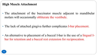 71
High Muscle Attachment
• The attachment of the buccinator muscle adjacent to mandibular
molars will occasionally obliterate the vestibule.
• The lack of attached gingiva further complicates I-bar placement.
• An alternative to placement of a buccal I-bar is the use of a lingual I-
bar for retention and a buccal rest extension for reciprocation.
 