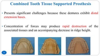 Combined Tooth Tissue Supported Prosthesis
8
• Presents significant challenges because these dentures exhibit distal
extension bases.
• Concentration of forces may produce rapid destruction of the
associated tissues and an accompanying decrease in ridge height.
 