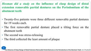 91
Hosman did a study on the influence of clasp design of distal
extension removable partial dentures on the Periodontium of the
abutment teeth
• Twenty-five patients wore three different removable partial dentures
for 19 weeks each.
• The first removable partial denture placed a tilting force on the
abutment teeth
• The second was stress-releasing
• The third collected the least amount of plaque
The Influence of Clasp Design of Distal Extension Removable Partial Dentures on the Periodontium of the Abutment Teeth. Int i Prosthodon
 