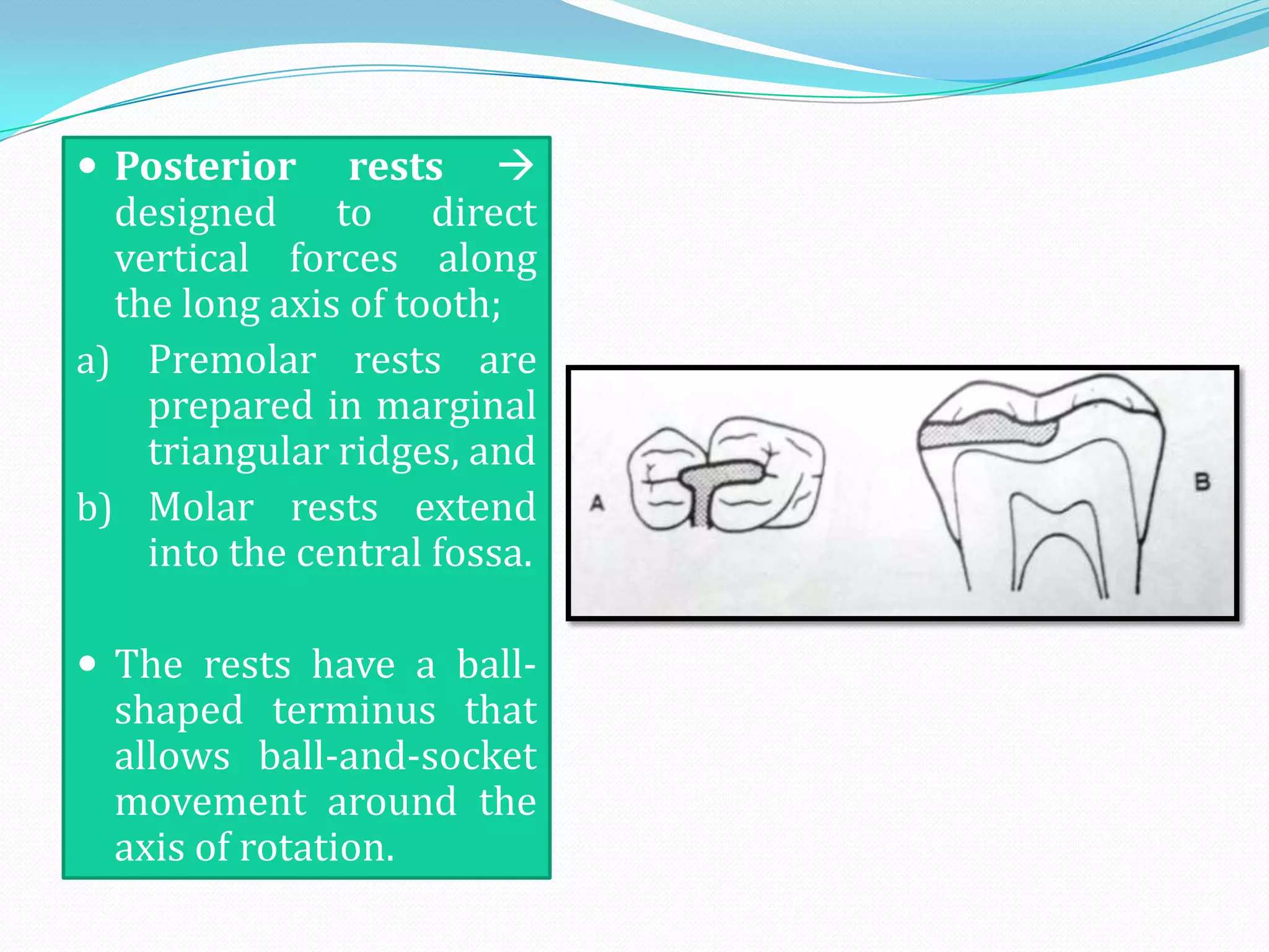  Posterior     rests 
  designed to direct
  vertical forces along
  the long axis of tooth;
a) Premolar rests are
    prepared in marginal
    triangular ridges, and
b) Molar rests extend
    into the central fossa.

 The rests have a ball-
  shaped terminus that
  allows ball-and-socket
  movement around the
  axis of rotation.
 