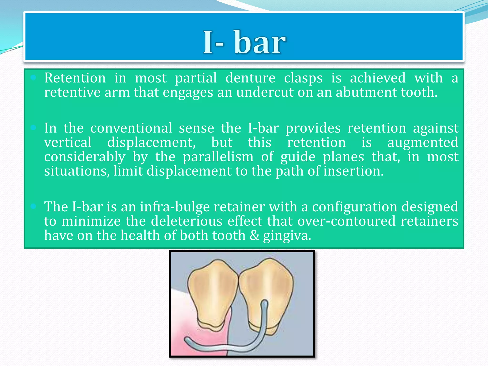  Retention in most partial denture clasps is achieved with a
  retentive arm that engages an undercut on an abutment tooth.

 In the conventional sense the I-bar provides retention against
  vertical displacement, but this retention is augmented
  considerably by the parallelism of guide planes that, in most
  situations, limit displacement to the path of insertion.

 The I-bar is an infra-bulge retainer with a configuration designed
  to minimize the deleterious effect that over-contoured retainers
  have on the health of both tooth & gingiva.
 