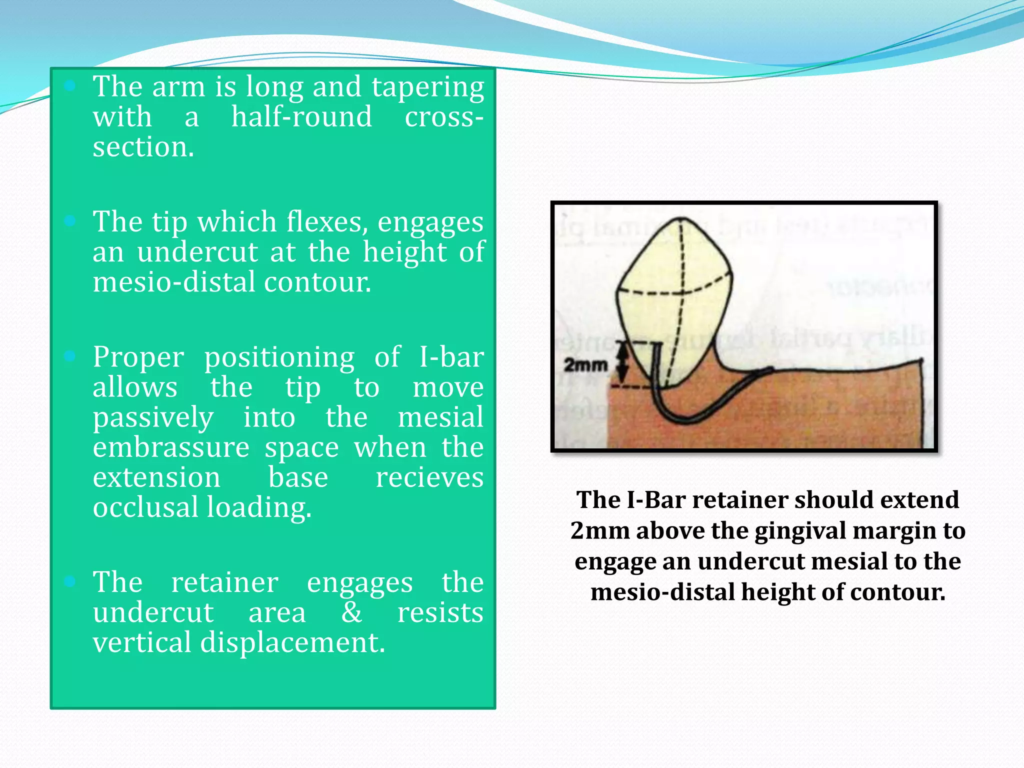  The arm is long and tapering
  with a half-round      cross-
  section.

 The tip which flexes, engages
  an undercut at the height of
  mesio-distal contour.

 Proper positioning of I-bar
  allows the tip to move
  passively into the mesial
  embrassure space when the
  extension base recieves
  occlusal loading.               The I-Bar retainer should extend
                                  2mm above the gingival margin to
                                  engage an undercut mesial to the
 The retainer engages the         mesio-distal height of contour.
  undercut area & resists
  vertical displacement.
 