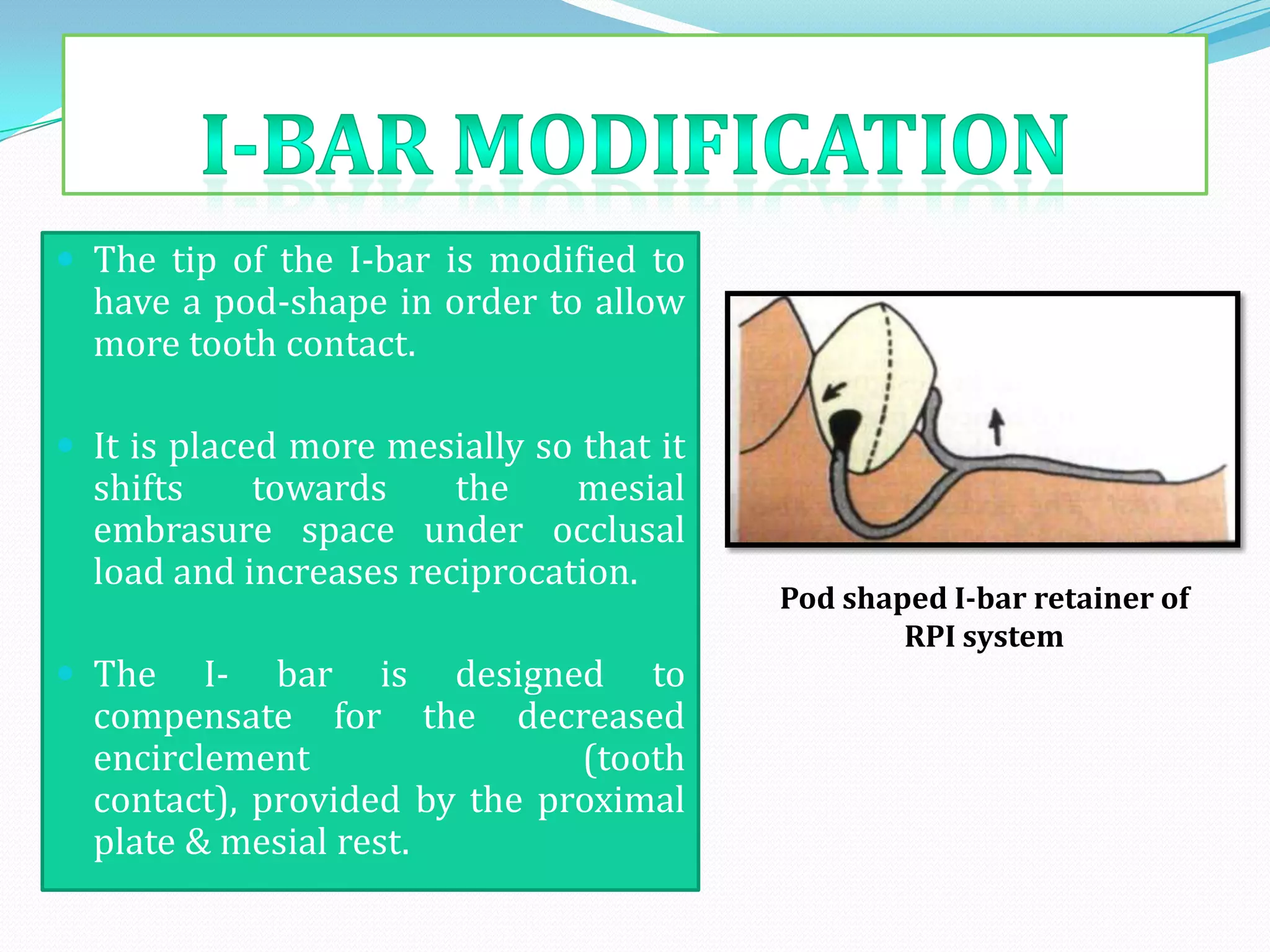  The tip of the I-bar is modified to
  have a pod-shape in order to allow
  more tooth contact.

 It is placed more mesially so that it
  shifts    towards     the    mesial
  embrasure space under occlusal
  load and increases reciprocation.
                                          Pod shaped I-bar retainer of
                                                  RPI system
 The    I- bar is designed to
  compensate for the decreased
  encirclement                (tooth
  contact), provided by the proximal
  plate & mesial rest.
 