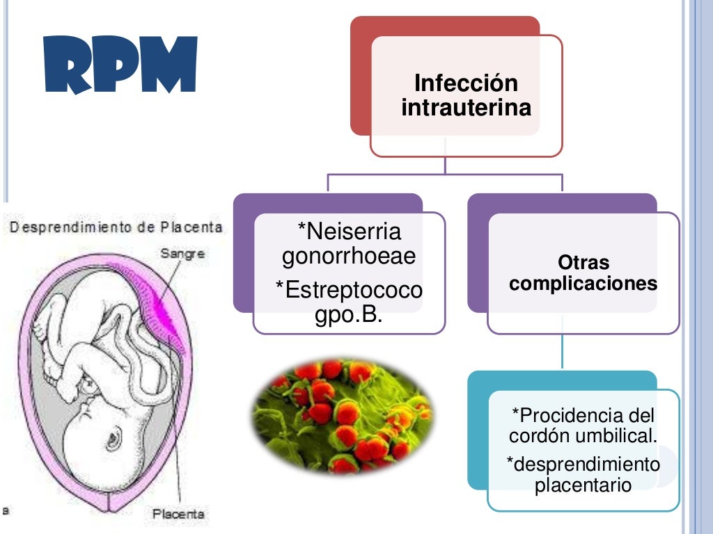 ruptura prematura de membranas