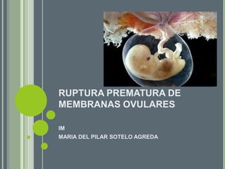 RUPTURA PREMATURA DE
MEMBRANAS OVULARES
IM
MARIA DEL PILAR SOTELO AGREDA

 