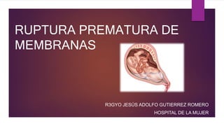 RUPTURA PREMATURA DE
MEMBRANAS
R3GYO JESÚS ADOLFO GUTIERREZ ROMERO
HOSPITAL DE LA MUJER
 