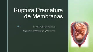 z
Ruptura Prematura
de Membranas
Dr. John K. Gavarrete Arauz
Especialista en Ginecologia y Obstetricia
 