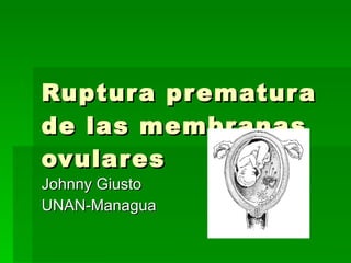 Ruptura prematura de las membranas ovulares Johnny Giusto UNAN-Managua 