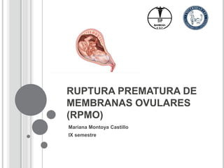 RUPTURA PREMATURA DE
MEMBRANAS OVULARES
(RPMO)
Mariana Montoya Castillo
IX semestre
 