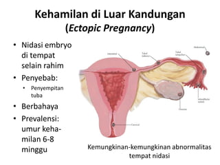 Kehamilan di Luar Kandungan
                    (Ectopic Pregnancy)
• Nidasi embryo
  di tempat
  selain rahim
• Penyebab:
  •   Penyempitan
      tuba
• Berbahaya
• Prevalensi:
  umur keha-
  milan 6-8
  minggu                Kemungkinan-kemungkinan abnormalitas
                                   tempat nidasi
 