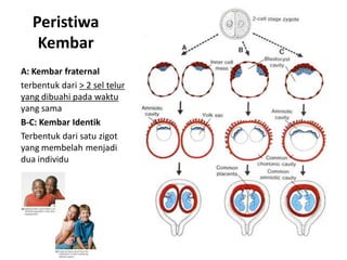 Peristiwa
    Kembar
A: Kembar fraternal
terbentuk dari > 2 sel telur
yang dibuahi pada waktu
yang sama
B-C: Kembar Identik
Terbentuk dari satu zigot
yang membelah menjadi
dua individu
 