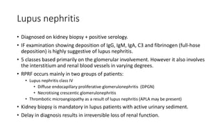Lupus nephritis
• Diagnosed on kidney biopsy + positive serology.
• IF examination showing deposition of IgG, IgM, IgA, C3 and fibrinogen (full-hose
deposition) is highly suggestive of lupus nephritis.
• 5 classes based primarily on the glomerular involvement. However it also involves
the interstitium and renal blood vessels in varying degrees.
• RPRF occurs mainly in two groups of patients:
• Lupus nephritis class IV
• Diffuse endocapillary proliferative glomerulonephritis (DPGN)
• Necrotising crescentic glomerulonephritis
• Thrombotic microangiopathy as a result of lupus nephritis (APLA may be present)
• Kidney biopsy is mandatory in lupus patients with active urinary sediment.
• Delay in diagnosis results in irreversible loss of renal function.
 
