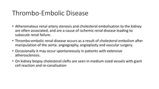 Thrombo-Embolic Disease
• Atheromatous renal artery stenosis and cholesterol embolisation to the kidney
are often associated, and are a cause of ischemic renal disease leading to
subacute renal failure.
• Thrombo-embolic renal disease occurs as a result of cholesterol embolism after
manipulation of the aorta: angiography, angioplasty and vascular surgery.
• Occasionally it may occur spontaneously in patients with extensive
atherosclerosis.
• On kidney biopsy cholesterol clefts are seen in medium sized vessels with giant
cell reaction and re-canalisation
 