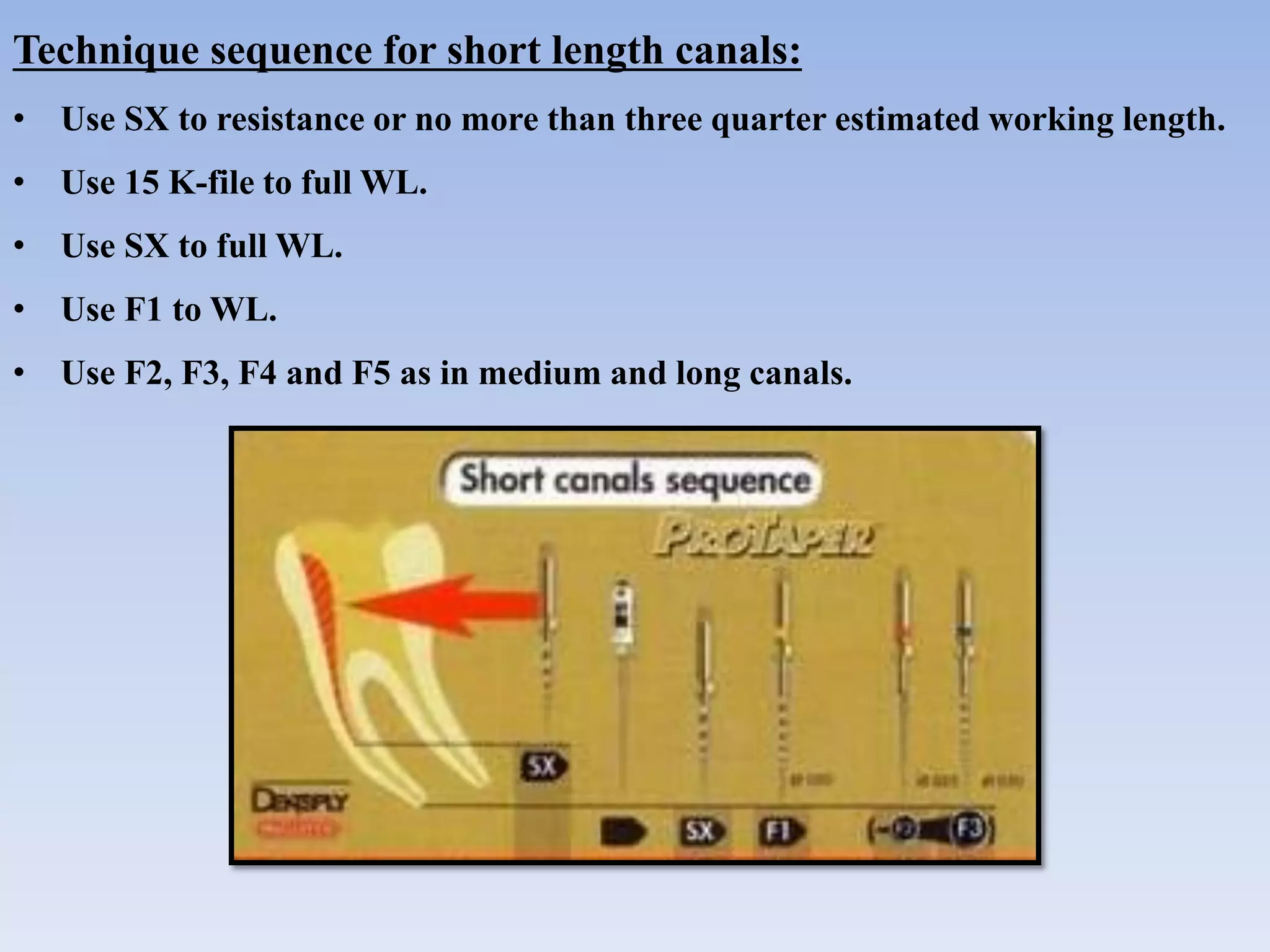 Technique sequence for short length canals:
• Use SX to resistance or no more than three quarter estimated working length.
• Use 15 K-file to full WL.
• Use SX to full WL.
• Use F1 to WL.
• Use F2, F3, F4 and F5 as in medium and long canals.
 
