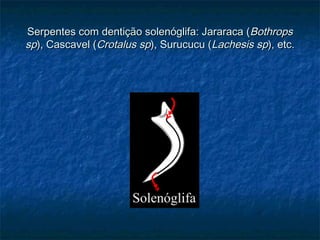 Serpentes com dentição solenóglifa: Jararaca (Bothrops
sp), Cascavel (Crotalus sp), Surucucu (Lachesis sp), etc.
 