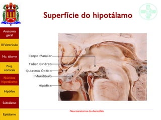 Neuroanatomia do diencéfalo
Anatomia
geral
III Ventrículo
Nu. tálamo
Proj.
corticais
Núcleos
hipotálamo
Hipófise
Subtálamo
Epitálamo
Superfície do hipotálamo
 