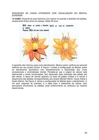DESCRIÇÃO DE CASOS ATENDIDOS COM VISUALIZAÇÃO DO MENTAL
SUPERIOR
1o CASO: Paciente do sexo feminino com câncer no pulmão e distúrbio há hipófise,
ocasionando fortes dores de cabeça. Idade 58 anos.
A paciente não retornou para outro atendimento. Mesmo assim verificou-se sensível
melhora em seu quadro clínico. A Figura 1 mostra a configuração do Mental, antes
do atendimento apométrico com desdobramento e dissociação dos níveis
conscienciais e cromoterapia mental. Percebe-se que a origem do câncer está
relacionada a várias encarnações, fato observado pela coloração das pétala das
três almas. A figura do câncer aparece na base da pétala nuclear e é visível a
desarmonia das pétalas correspondentes aos corpos Mental Inferior, Corpo Astral e
Duplo Etérico. Na Figura 2, temos a configuração do Mental após o atendimento. A
cor azul, segundo os orientais, é a ideal para o tratamento do câncer, pois
permanece envolvendo as pétalas onde anteriormente se verificava as maiores
desarmonias.
83
 