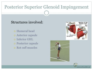 Structures involved:
 Humeral head
 Anterior capsule
 Inferior GHL
 Posterior capsule
 Rot cuff muscles
www.shoulder....