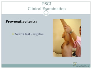 PSGI
Clinical Examination
Provocative tests:
 Neer’s test = negative
www.shoulder.gr
 