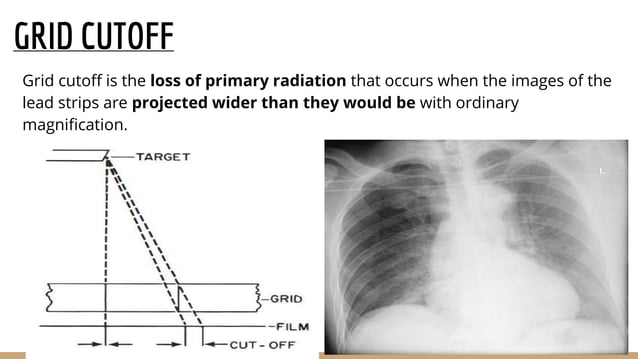 Filters grids and collimators | PPTX | Eye and Vision Conditions ...