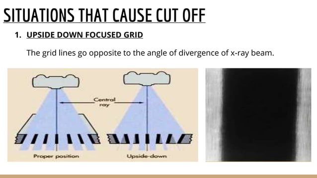 Filters grids and collimators | PPTX | Eye and Vision Conditions ...