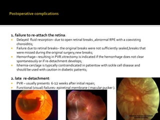 1. failure to re-attach the retina:






Delayed fluid resorption- due to open retinal breaks ,abnormal RPE with a coexisting
choroiditis;
Failure due to retinal breaks– the original breaks were not sufficiently sealed,breaks that
were missed during the original surgery,new breaks;
Hemorrhage– resulting in PVR.vitrectomy is indicated if the hemorrhage does not clear
spontaneously or if re-detachment develops;
Ishemia-cerclage is typically contraindicated in patientsw with sickle cell disease and
should be used with caution in diabetic patients;

2. late re-detachment:



PVR – usually presents 6-12 weeks after initial repair;
Functional (visual) failures- epiretinal membrane ( macular pucker ).

 