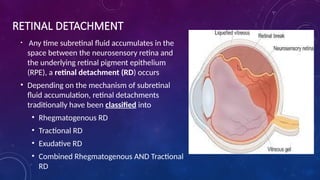 Mild Tractional Rd RRD. for ophthalmology doctors in practice pptx | PPTX