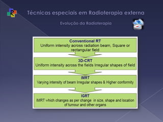 Técnicas especiais em Radioterapia externa Evolução da Radioterapia