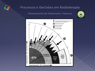 Processos e Decisões em Radioterapia Planeamento do Tratamento: Volumes