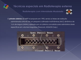 Técnicas especiais em Radioterapia externa   Radioterapia com Intensidade ModuladaO primeiro sistema de IMRT foi proposto em 1992, sendo os feixes de radiação administrados através de um pequeno colimador multi-lâminas (MLC) dinâmico de 1cm de largura (MiMic) operado por um sistema concebido para administrar doses específicas em volumes irregulares (Peacock, NOMOS Corp.)
