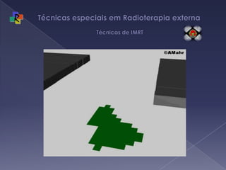 Técnicas especiais em Radioterapia externa   Técnicas de IMRT