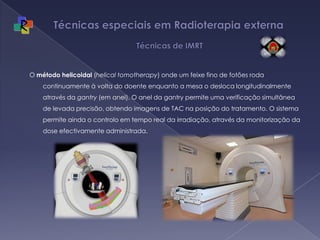 Técnicas especiais em Radioterapia externa   Técnicas de IMRTO método helicoidal (helical tomotherapy) onde um feixe fino de fotões roda continuamente à volta do doente enquanto a mesa o desloca longitudinalmente através da gantry (em anel). O anel da gantry permite uma verificação simultânea de levada precisão, obtendo imagens de TAC na posição do tratamento. O sistema permite ainda o controlo em tempo real da irradiação, através da monitorização da dose efectivamente administrada. 