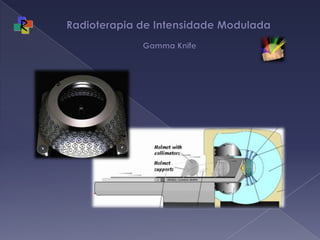 Radioterapia de Intensidade Modulada   Gamma Knife