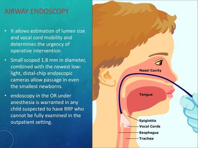 Rrp Rrp recurrent respiratory papillomatosis | PDF