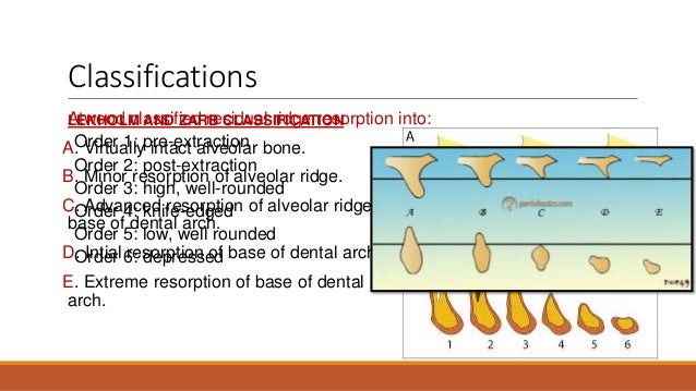 RESIDUAL RIDGE RESORPTION