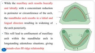 15
• While the maxillary arch resorbs buccally
and labially with a concomitant reduction
in perimeter or circumference of the arch,
the mandibular arch resorbs in a labial and
lingual direction resulting in widening of
the arch posteriorly.
• This will lead to confinement of maxillary
arch within the mandibular arch in
longstanding edentulous situations, giving
a pseudo-class III ridge relationship
 