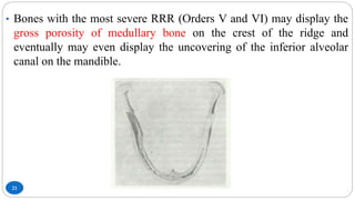 21
• Bones with the most severe RRR (Orders V and VI) may display the
gross porosity of medullary bone on the crest of the ridge and
eventually may even display the uncovering of the inferior alveolar
canal on the mandible.
 