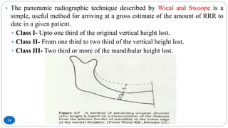 24
• The panoramic radiographic technique described by Wical and Swoope is a
simple, useful method for arriving at a gross estimate of the amount of RRR to
date in a given patient.
• Class I- Upto one third of the original vertical height lost.
• Class II- From one third to two third of the vertical height lost.
• Class III- Two third or more of the mandibular height lost.
 