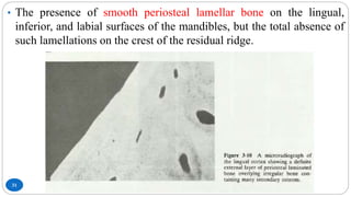31
• The presence of smooth periosteal lamellar bone on the lingual,
inferior, and labial surfaces of the mandibles, but the total absence of
such lamellations on the crest of the residual ridge.
 