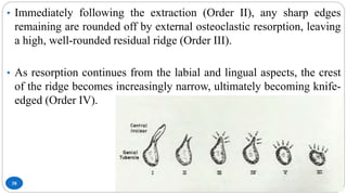 38
• Immediately following the extraction (Order II), any sharp edges
remaining are rounded off by external osteoclastic resorption, leaving
a high, well-rounded residual ridge (Order III).
• As resorption continues from the labial and lingual aspects, the crest
of the ridge becomes increasingly narrow, ultimately becoming knife-
edged (Order IV).
 