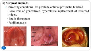 75
ii) Surgical methods
• Correcting conditions that preclude optimal prosthetic function
• Localized or generalized hyperplastic replacement of resorbed
ridges.
• Epulis fissuratum
• Papillomatosis
 