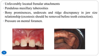 76
• Unfavorably located frenular attachments
• Pendulous maxillary tuberosities
• Bony prominences, undercuts and ridge discrepancy in jaw size
relationship (exostosis should be removed before tooth extraction).
• Pressure on mental foramen.
 