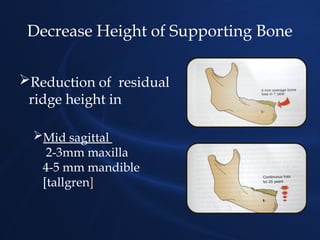 Residual ridge resorption powerpoint presentation | PPTX