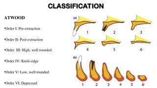 Residual Ridge Resorption in Prosthodontics .ppt