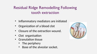 Rrrr (1).pptxppt of residual ridge resorption | PPTX