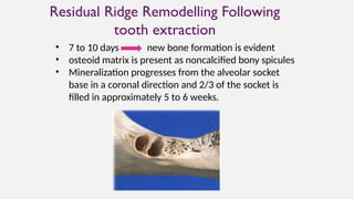Stallion Coronal Ridge Rrrr (1).pptxppt of residual ridge resorption | PPTX